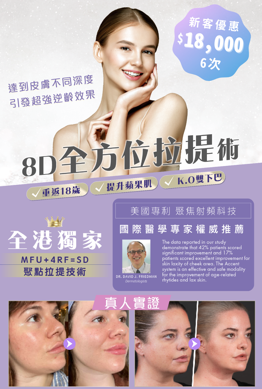 8D全方位拉提術